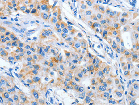 IMMT Polyclonal Antibody Store at -20°C