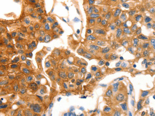 MVP Polyclonal Antibody Store at -20°C