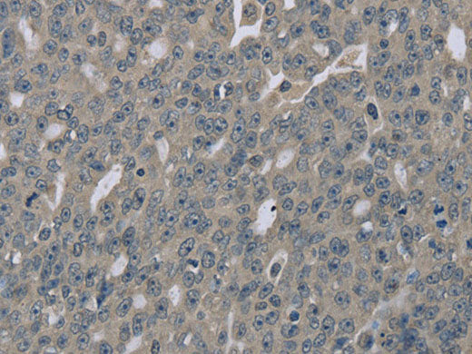 EDN1 Polyclonal Antibody Host Rabbit