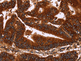 GCKR Polyclonal Antibody Host Rabbit