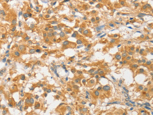 ATG5 Polyclonal Antibody Store at -20°C