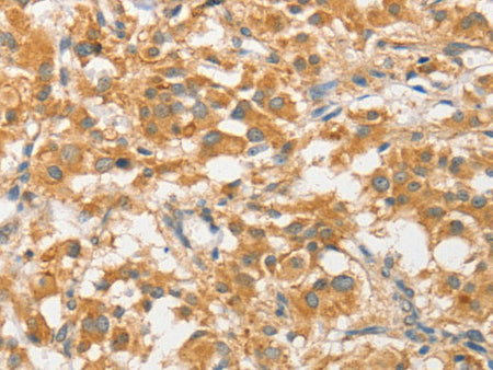 ATG5 Polyclonal Antibody Store at -20°C