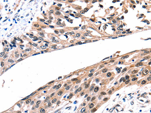 Connexin-26 Polyclonal Antibody Store at -20°C
