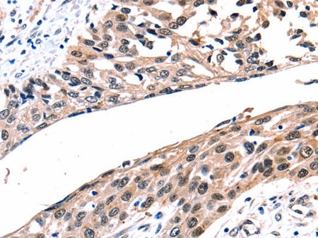 Connexin-26 Polyclonal Antibody Store at -20°C