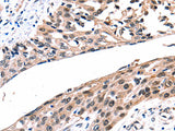 Connexin-26 Polyclonal Antibody Store at -20°C