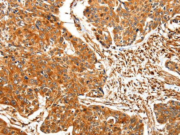 TPM2 Polyclonal Antibody Store at -20°C