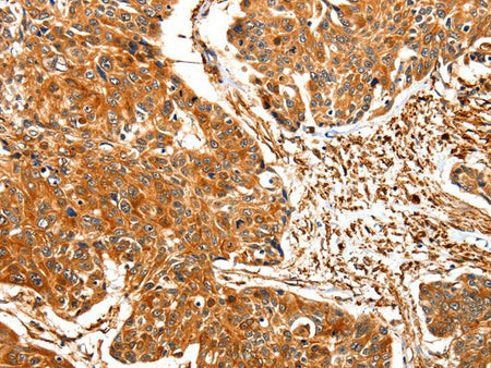 TPM2 Polyclonal Antibody Store at -20°C