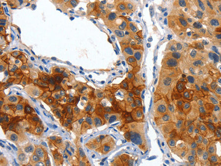 Placental Alkaline Phosphatase Polyclonal Antibody Store at -20°C