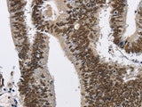 CMTM2 Polyclonal Antibody Store at -20°C