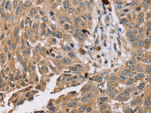 PDLIM7 Polyclonal Antibody Store at -20°C