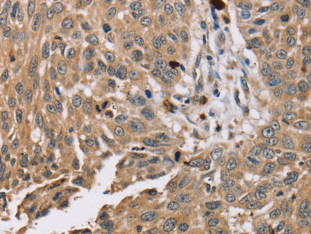 PDLIM7 Polyclonal Antibody Store at -20°C