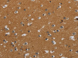 CSH1 Polyclonal Antibody Store at -20°C