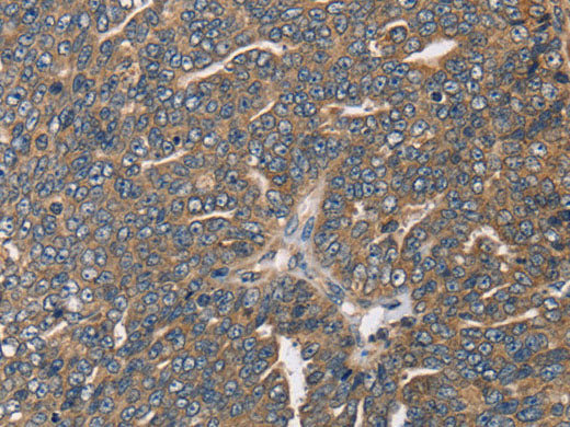HSD17B12 Polyclonal Antibody Store at -20°C