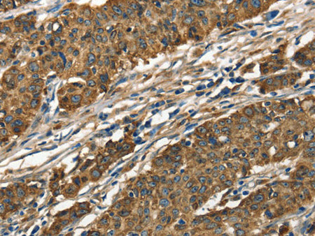 Cathepsin E Polyclonal Antibody Store at -20°C
