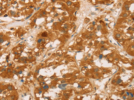 CD43 Polyclonal Antibody Store at -20°C