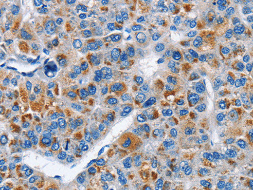 CREB2 Polyclonal Antibody Store at -20°C