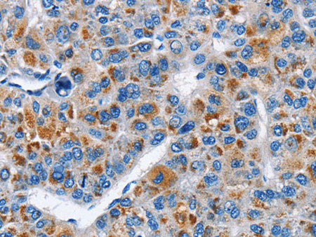 CREB2 Polyclonal Antibody Store at -20°C
