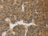 TNFRSF10D Polyclonal Antibody Store at -20°C