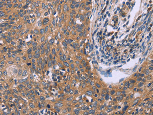 IL3RB Polyclonal Antibody - Biomarkers - Elabscience Biotechnology - MSE Supplies