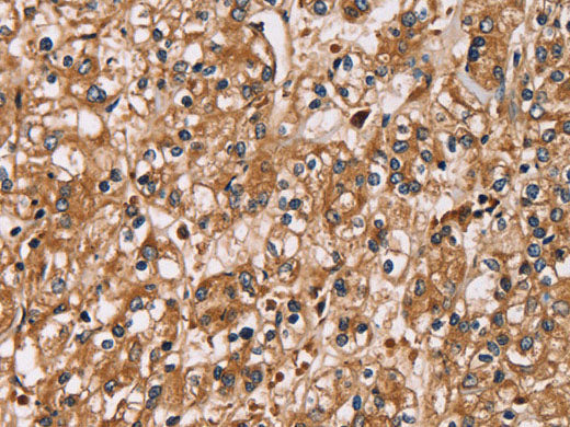 HTR3C Polyclonal Antibody Store at -20°C