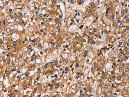 HTR3C Polyclonal Antibody Store at -20°C