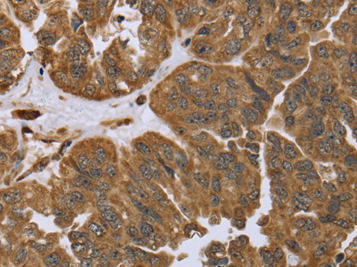 IKBIP Polyclonal Antibody Store at -20°C