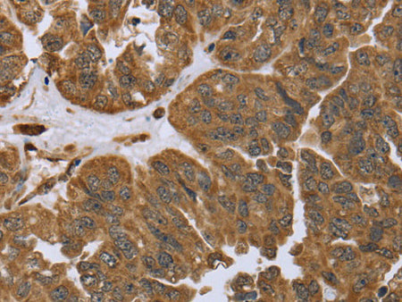 IKBIP Polyclonal Antibody Store at -20°C