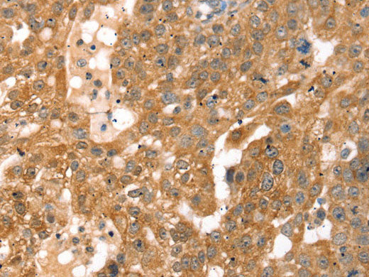 RPS6KA1 Polyclonal Antibody Store at -20°C