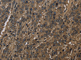 GSTO1 Polyclonal Antibody