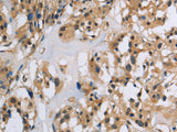 IL5RA Polyclonal Antibody Store at -20°C