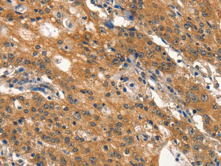 DNM2 Polyclonal Antibody Store at -20°C