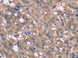NRG1 Polyclonal Antibody Store at -20°C
