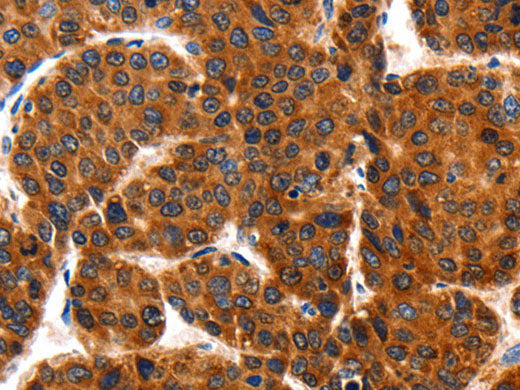 HSP75 Polyclonal Antibody Store at -20°C