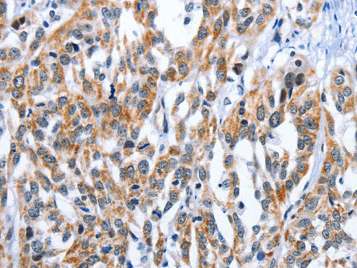 EDN3 Polyclonal Antibody Store at -20°C