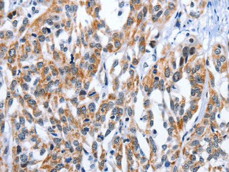 EDN3 Polyclonal Antibody Store at -20°C