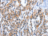 EDN3 Polyclonal Antibody Store at -20°C