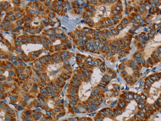 MRPL28 Polyclonal Antibody Store at -20°C - MSE Supplies LLC