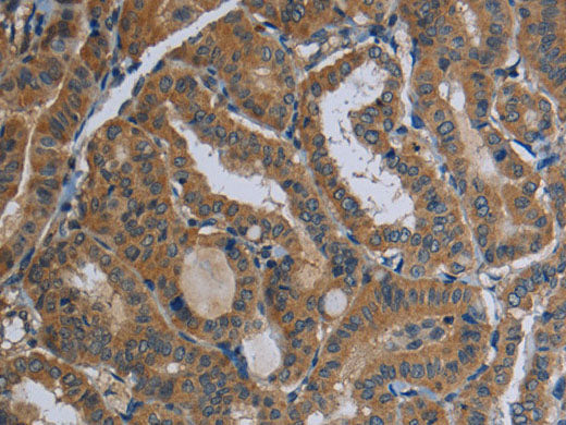 FAAH Polyclonal Antibody Store at -20°C