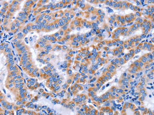 CCR6 Polyclonal Antibody Store at -20°C
