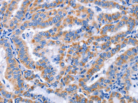 CCR6 Polyclonal Antibody Store at -20°C