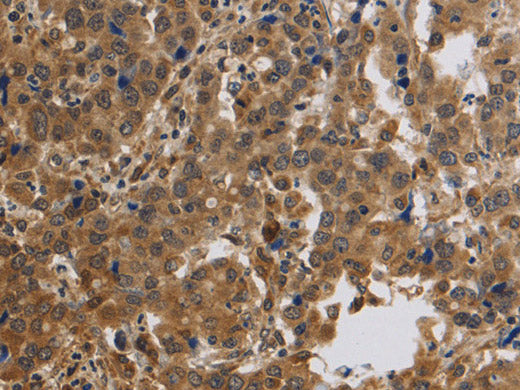 KCNMB4 Polyclonal Antibody Store at -20°C