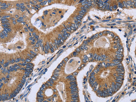 GABPB2 Polyclonal Antibody Store at -20°C