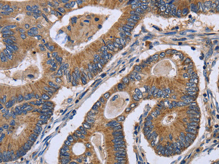 GABPB2 Polyclonal Antibody Store at -20°C