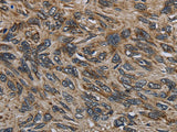 CD236 Polyclonal Antibody Store at -20°C