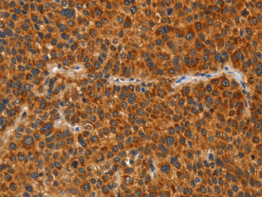 IKZF3 Polyclonal Antibody Store at -20°C