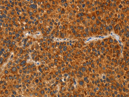IKZF3 Polyclonal Antibody Store at -20°C