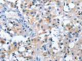 ASB2 Polyclonal Antibody Store at -20°C