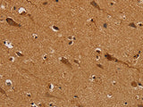 NDUFS5 Polyclonal Antibody