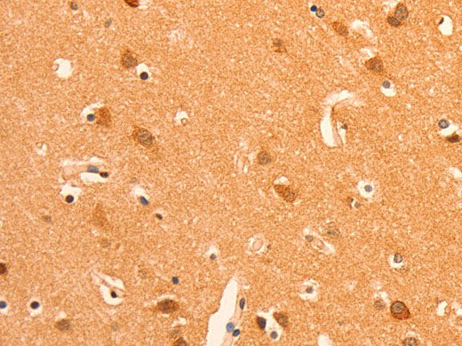 GRM3 Polyclonal Antibody Store at -20°C