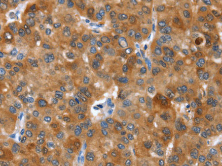 NOD2 Polyclonal Antibody 	Store at -20°C